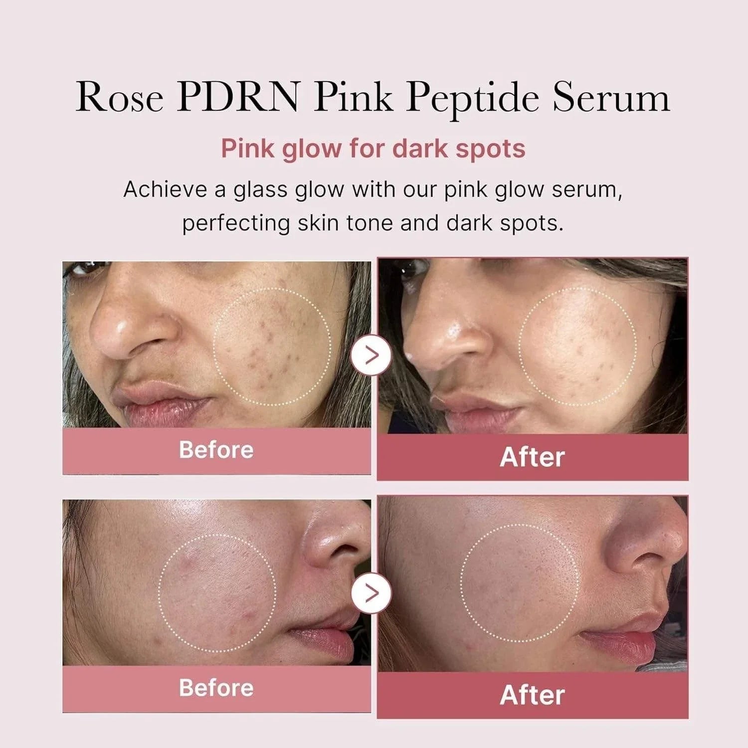 medicube PDRN Pink Peptide Serum 30ml / 1.01 oz– SALMON DNA For Anti-Aging Care